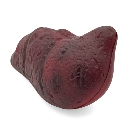Stress Damaged Liver End