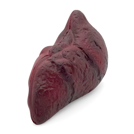 Stress Damaged Liver End Alternate